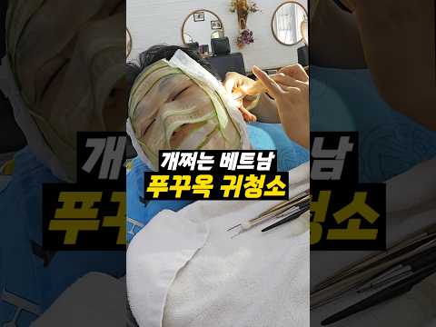 베트남 귀청소 스페샬 서비스, 