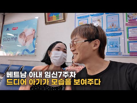 베트남🇻🇳아내와 함께 산부인과에 두번째 검사를 위해 방문하였습니다, 